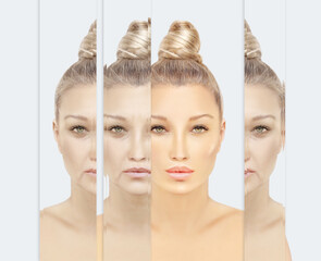 Signs of skin aging,signs of premature aging, Wrinkles and fine lines,Age spots,Sagging skin,Dehydrated skin,eyelid area