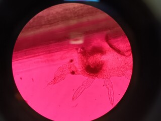 thrip under a microscope