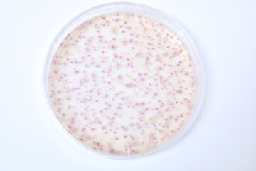 Colonies of bacteria growth on agar plate medium in laboratory.	