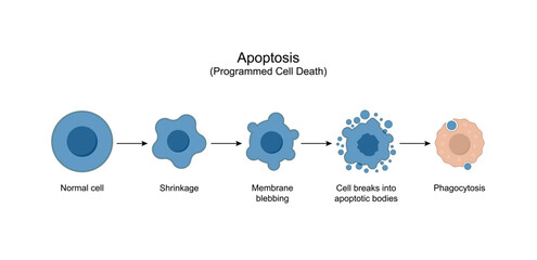 Apoptosis. Programmed cell death. Aging process in cells. Stages of apoptosis, normal cell, shrinkage, membrane blebbing, cell breaks into apoptotic bodies and phagocytosis. Vector illustration.