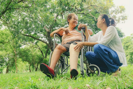 Daughter or nurse caring an elderly disabled woman who has had her legs amputated and is in a wheelchair and is being treated diabetes holds prosthetic leg to be fitted relieve her disability.