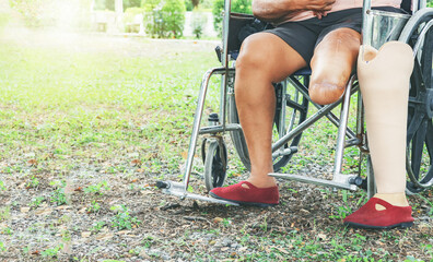 Disabled elderly woman in wheelchair due severe chronic diabetes which caused inflammation foot...