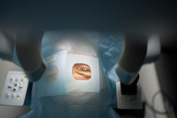 Middle aged woman lying on operating table undergoing eye surgery with medical drape covering face...