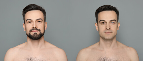 Handsome man before and after shaving on grey background, collage of photos. Banner design