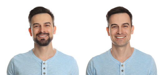 Handsome man before and after shaving on white background, collage of photos