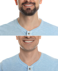 Man before and after shaving on white background, closeup. Collage of photos