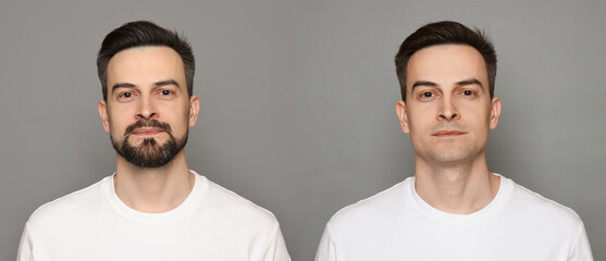 Handsome man before and after shaving on grey background, collage of photos. Banner design