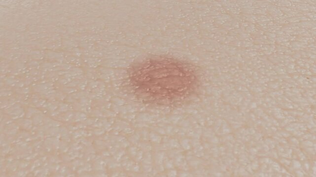 Golden medicine balls or essence bubbles for acne treatment, molecules penetrating skin layers to remove inflammatory acne, white pimples, skin care beauty solution, cosmetics ads, 3d rendering.