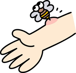 Bee sting