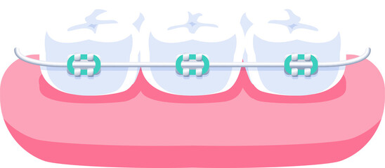 Orthodontics (braces) illustration design. Dental care concept.
