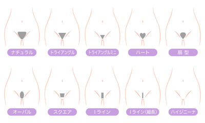 女性　アンダーヘアのデザイン　脱毛