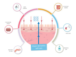 Atopic dermatitis self care infographic showing damaged skin and treatment options