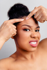 Young woman performs skincare routine pressing pimple on forehead, promoting clean and healthy...