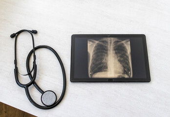 Table with phonendoscope, and a X ray image of the lungs with pneumonia on the tablet. Healthcare