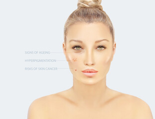 effects of sun exposure on facial skin
