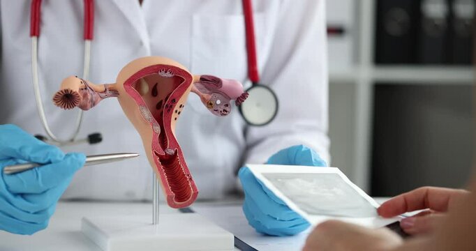 Gynecologist wearing blue gloves points to model of reproductive system while patient holds ultrasound scan. Explaining results during consultation