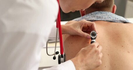 Dermatologist examines back skin of male patient using handheld dermatoscope. Doctor checks birthmarks and moles for asymmetry and color changes - Powered by Adobe