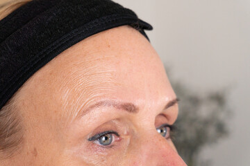 Macro view of a middle-aged woman’s forehead, brow and eye showing fine lines and skin texture....