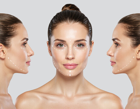 beauty women skincare face lift skin tightening cosmetic treatment