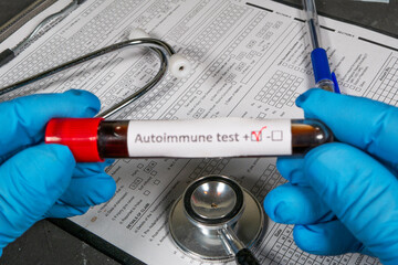 Doctor holding positive autoimmune test blood sample tube