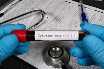 Doctor holding positive cytokine test blood sample near medical form