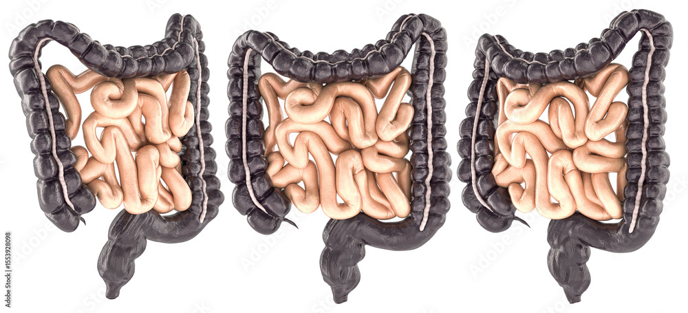 Poster set of human intestines, including large and small bowel, realistic anatomical 3d model. side and fr