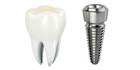 Dental Implant and Tooth, 3D Render, Isolated on Transparent Background, Dental Prosthesis, Dental Implant, Tooth Crown, Dentistry
