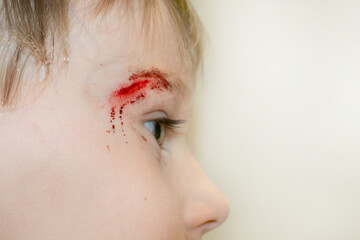 Close-up of the boy's face with a sadina. The child treats the wound on the face. High quality photo