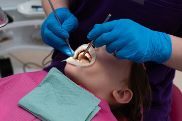 Dental treatment in progress at a modern clinic highlighting meticulous care and advanced...