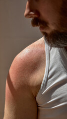 Naklejka premium Skin-realism. Sun-kissed man shoulder, visible tan lines and real pores. Natural beauty. Concept of skin care and sun protection reminder.