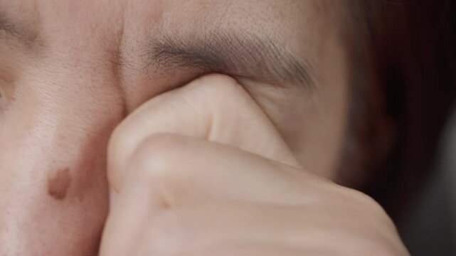 Senior asian woman is periorbital eye fatigue.