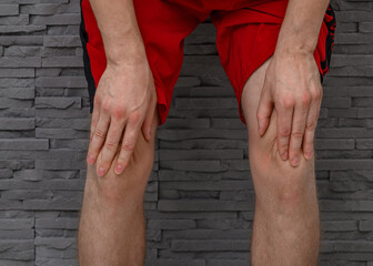 Male athlete holding his knees, pain after strain