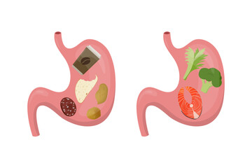 Healthy and unhealthy food showing good and bad nutrition for stomach and gut