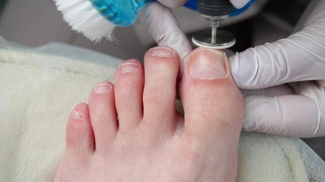 Hardware pedicure, grinding toes with an abrasive pedicure disc