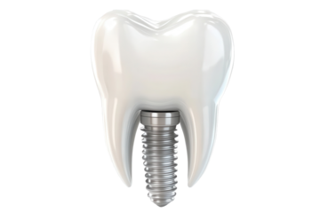 Model of a tooth featuring an implant screw demonstrates dental restoration techniques and advancements in oral health
