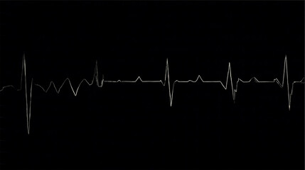 Pacemaker ECG with a ventricular extrasystole.