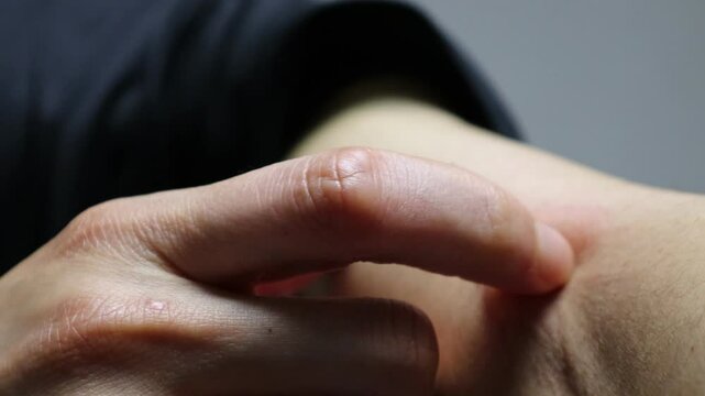 蚊に刺された腕を掻く人物の動画
