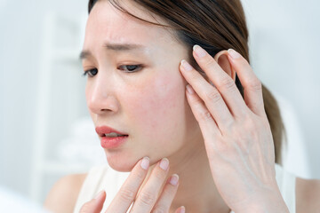 Woman worried about face Dermatology, rosacea dermatitis, allergic steroids, sensitive skin, red...