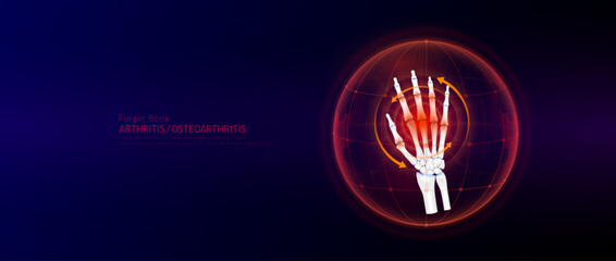 Red rotating arrow around finger joint cartilage inflammation in dome on blue background. Arthritis and osteoarthritis. Human hand skeleton anatomy. Medical science concept. Vector EPS10.