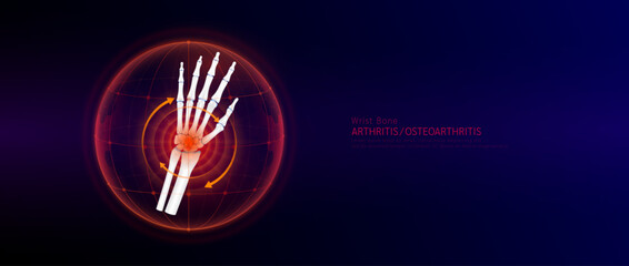 Red rotating arrow around wrist joint cartilage inflammation in dome on blue background. Arthritis and osteoarthritis. Human hand skeleton anatomy. Medical science concept. Vector EPS10.