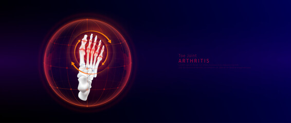 Red rotating arrow around toe joint cartilage inflammation in dome on blue background. Arthritis and osteoarthritis. Human foot skeleton anatomy. Medical science concept. Vector EPS10.