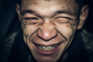 marginal person, drug addict or alcoholic man close-up 