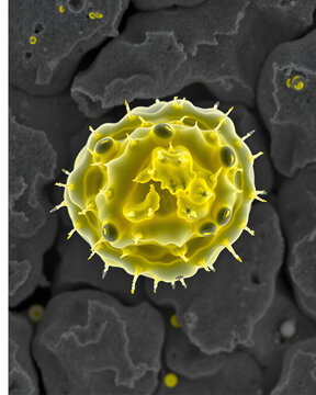 Scanning electron microscope image of human skin cells (keratinocytes), showing cell layers and microvilli, in shades of gray with yellow highlights, in extreme close-up.