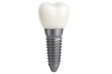 Close-up of a dental implant, showcasing the abutment and crown. Transparent
