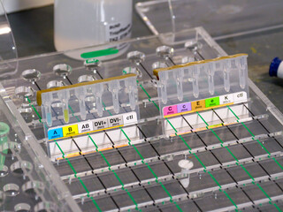 Laborutensilien Bluttest