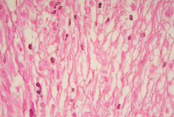 Medical themes: Microscopic view of Histoplasma capsulatum, PAS staining