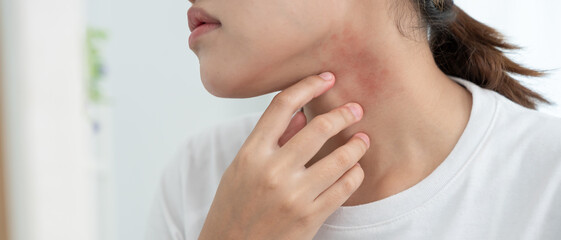 Skin and beauty problems Women have itchy skin and red rashes from cosmetic allergies, steroid...