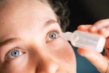 Top view young woman putting eye drops at home, female with heterochromia feeling eye fatigue and...