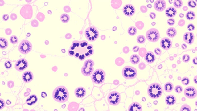 Histological slide of thyroid follicles, stained with hematoxylin and isomer, showing colloid cells (pink) and follicular cells (purple nuclei), with a realistic capillary reticulum pattern. 