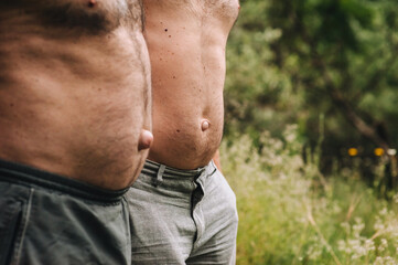 Photograph, portrait of a family of adult men, two people, father and son, with umbilical hernias...